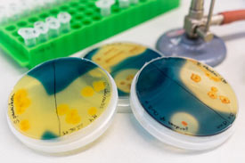 Verfahren zum Nachweis von Bakterienkulturen