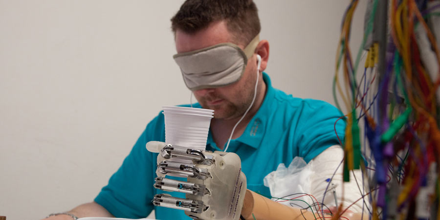 Student mit elektronischer Handprothese