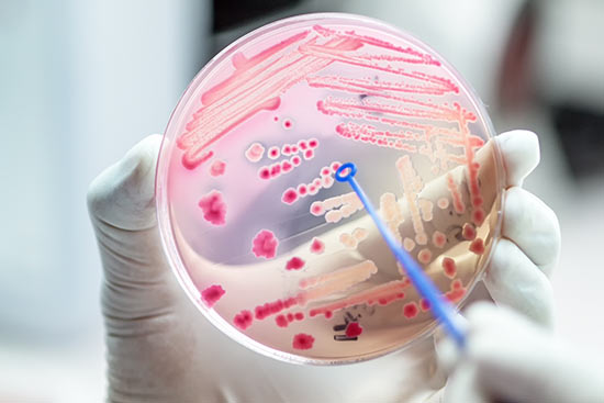 Petrischale mit Bakterienkultur im Labor von einer Hand gehalten
